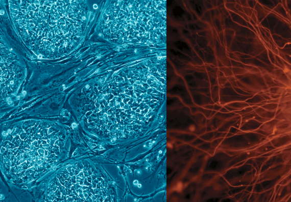 Cellules souches embryonnaires humaines Cellules souches embryonnaires humaines